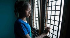 Krutý osud mladučkej tínedžerky: Jej pokožka pri kontakte so slnkom krváca