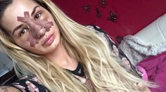 Spoznáte ju? Bývalá slovenská playmate si ľahla pod nôž