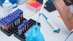 Vedci testujú vírus, ktorý má stopercentnú úmrtnosť. Priebeh ochorenia je desivý