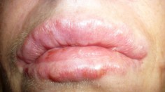 Chcela byť krásna, takto dopadla!