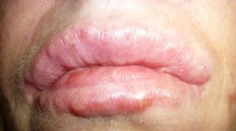 Chcela byť krásna, takto dopadla!