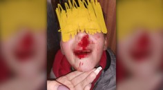 Osemročného chlapca zrazilo v Žiline auto, vodič nepomohol a odišiel. Mama aj polícia žiadajú o pomoc