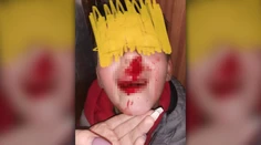 Osemročného chlapca zrazilo v Žiline auto, vodič nepomohol a odišiel. Mama aj polícia žiadajú o pomoc