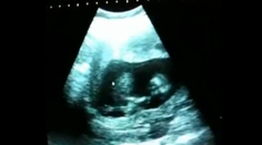 Skvelá tanečníčka! A to sa ešte ani nenarodila