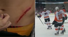 Hokejisti nie sú futbalisti. Schenn dostal korčuľou do brucha, vrátil sa a rozhodol