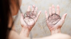 Pozor na ne. Nadmerné užívanie týchto vitamínov môže viesť k vypadávaniu či rednutiu vlasov