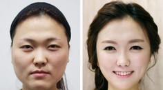 Ani vlastná mater ich nespozná. Výsledok šikovných plastických chirurgov