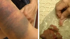 Dobitá, ešte aj prišla o zuby. Žena doplatila na stav nemocnice