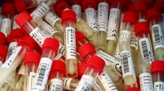 V pondelok potvrdili koronavírus 15 pacientom, hospitalizovaných je stále viac