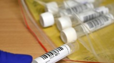 PCR testy odhalili 3 208 nových prípadov COVID-19, najviac bolo v Prešovskom kraji