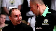 Neskutočný zvrat v Prievidzi. Skrvavený rozhodca a šialene smutní ľudia