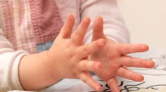 Len dvojročná Astrid prekonala tri mozgové mŕtvice. Spúšťačom boli zrejme ovčie kiahne