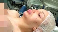 Drobné telo modelky neustálo obrie implantáty. Akútna operácia
