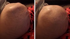 Neuveriteľné zábery. Takto sa hýbe dieťa v brušku tesne pred pôrodom