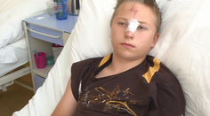 Chlapec sa druhýkrát narodil. Zo stehna si vytiahol riadidlá z bicykla