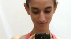 Vyzerala katastrofálne. Prestala jesť a mala len 35 kilogramov