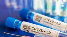 Vedci našli úplne prvého Európana, ktorý sa nakazil koronavírusom. Zverejnili, o koho ide