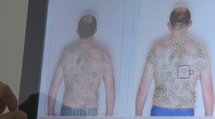 Pozor na UV žiarenie spôsobujúce rakovinu. Na Slovensku najviac ohrozuje tieto skupiny ľudí