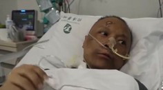 Čínskym lekárom nakazeným COVID-19 stmavla pleť. Ich kolegovia majú zopár teórií