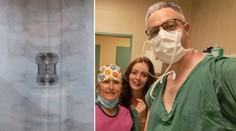 V týchto dňoch riešili akútne operácie malých detí. Lekári majú pre rodičov dôležitý odkaz