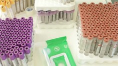 Minister Krajčí nástojí na masívnom testovaní. Prípravy na vakcináciu sú podľa neho v plnom prúde