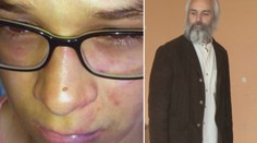 Zvrat v kauze dobitého chlapca. Riaditeľ odstúpil a priznal zlyhanie