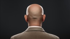 Nádej pre "nespravodlivo" plešatých ľudí. Vedci prelomili poslednú bariéru