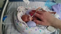Po pôrode nevážila ani pol kila. Zachránilo ju aj igelitové vrecko od známeho reťazca