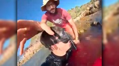 VIDEO: Žralok ho pripravil o nohu. Talian zverejnil desivé zábery a prezradil, ako sa mu podarilo prežiť