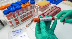 Koordinátor boja proti covidu radí nespoliehať sa na kolektívnu imunitu