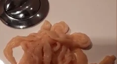 VIDEO: Muža vyľakal na toalete hrozivý pohľad. Z tela si vybral živú pásomnicu