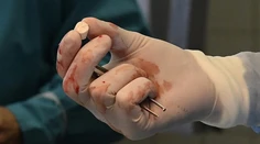 Košickí vedci vyvinuli unikátny biomateriál