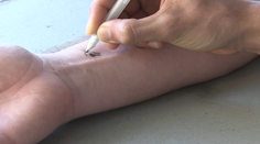 Zázračná ceruzka! Odhalí aj tie najzákernejšie choroby