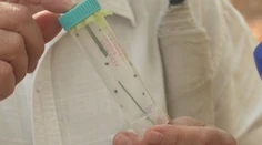 Niekde prežili aj horúčavy. Odborníci hlásia návrat kliešťov, problém to je aj pre majiteľov psov
