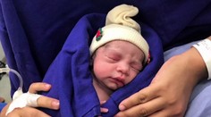 Medicínsky zázrak! Narodilo sa dieťa z transplantovanej maternice