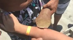 Ženu prevážali do nemocnicu aj so zahryznutým žralokom na ruke