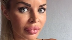 Silvia Kucherenko konečne prezradila, prečo má také veľké pery