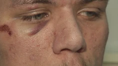 Jazda dvoch mladíkov sa zmenila na nočný horor. Jeden z nich skončil v nemocnici