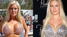 Nový trend v Hollywoode: Odstránenie silikónov!