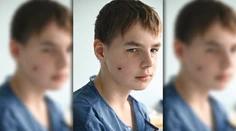 Je dieťa a už vie, čo je to vojnové zranenie. Slovenskí lekári zachránili tvár chlapcovi, ktorý prežil bombardovanie Charkova
