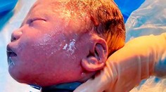 Lekári neverili vlastným očiam. Bábätko malo okolo krku šesťkrát omotanú pupočnú šnúru