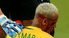 Neymar prekonal Zica a skončil zakrvavený, Argentína sa bez Messiho trápi