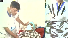 Policajtovi odstránili zo žalúdka 40 nožov, ktoré prehltol