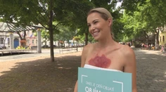 Niektorí sa jej stále boja. Pozrite si reakcie Slovákov na figurantku so psoriázou