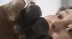 Žena bojuje s koronavírusom päť mesiacov. V dôsledku nákazy jej stmavli prsty