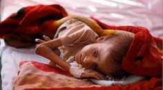 Štatistika, z ktorej je do plaču. Až 1,4 miliónu detí hrozí smrť hladom