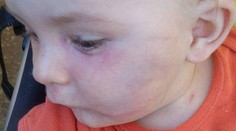 Až facka malému dieťaťu odhalila chybu v systéme. Čo na to kompetentní?