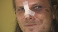 Dobýjal sa do cudzieho bytu, skončil so zlomenými rebrami: Inšpekcia sťažnosť zamietla
