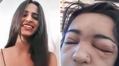 Odignorovala zákaz matky. Izabela (†15) si sama prepichla obočie, zomrela na ťažkú infekciu