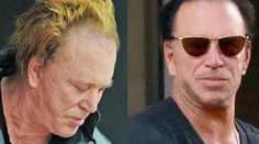 Mickey Rourke je po plastike. Už sa dá naňho viac pozerať